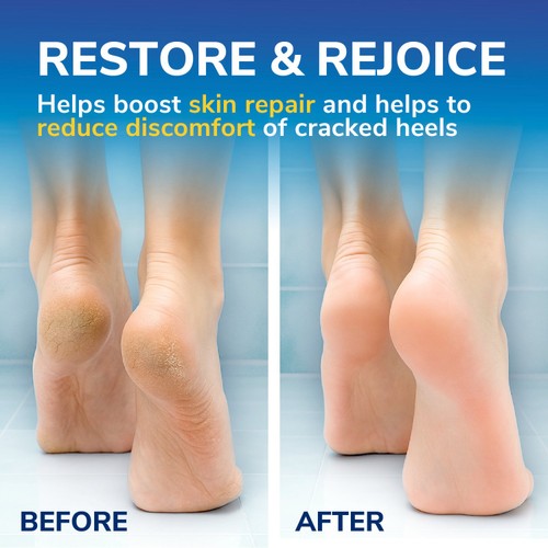 Scholl Cracked Heel Cream