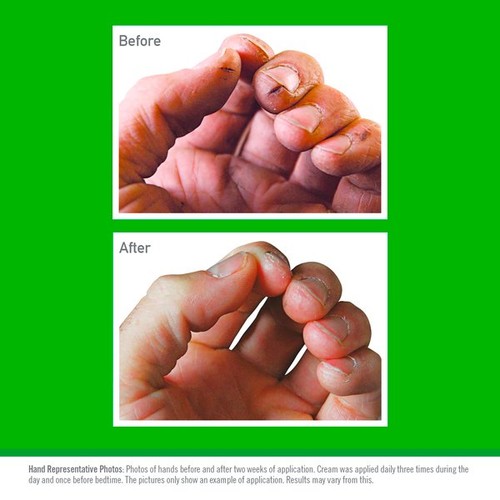 O' Keeffe's Working Hands