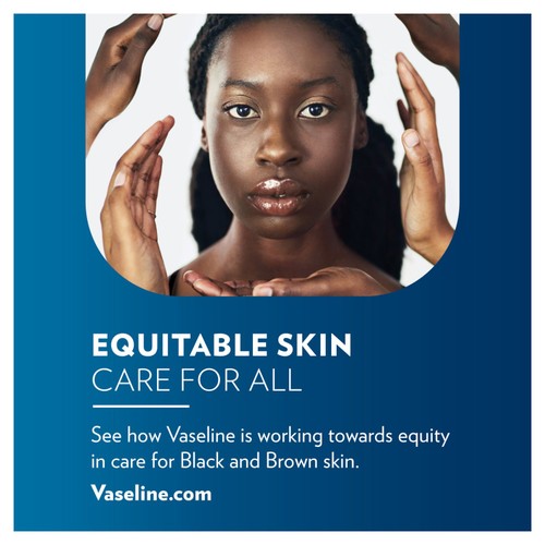 Vaseline Lip Therapy Original Lip Balm 10g