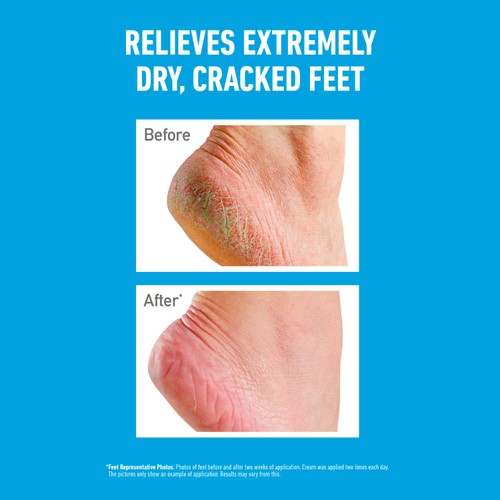 O'Keeffe's Healthy Feet Tube 