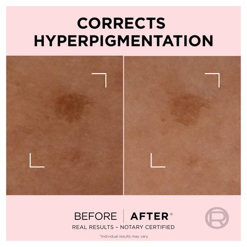 L'Oreal Skin Expert Age Perfect Spot Corrector 