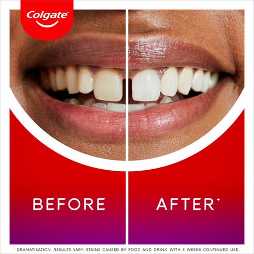 Colgate Max White Ultimate Radiance Whitening Toothpaste