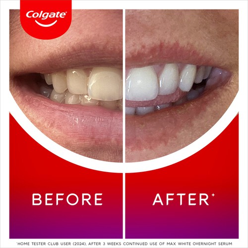 Colgate Max White Overnight Whitening Wand 