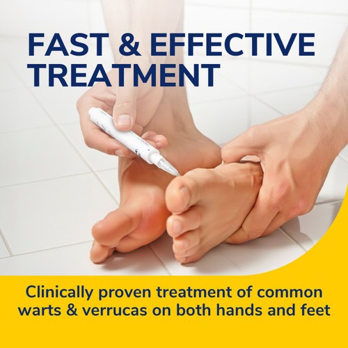 Scholl Wart & Verruca Pen 