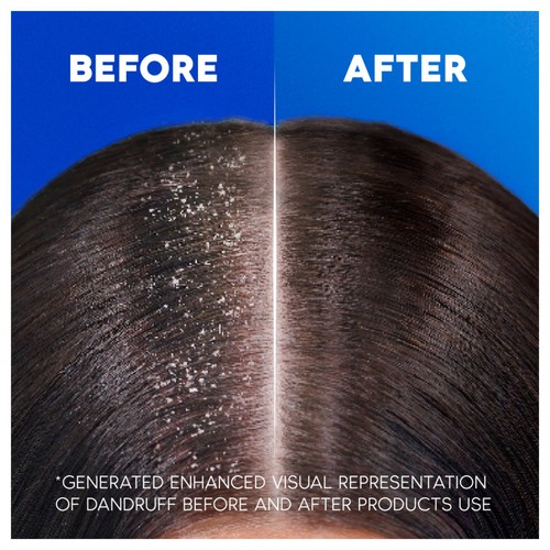 Head and Shoulders Classic Clean Anti Dandruff Shampoo