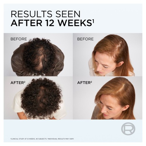 L'Oreal Elvive Growth Booster Shampoo