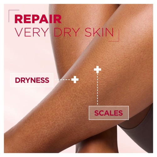Mixa Renewing Cream 10% Urea & Amino Acid 400ml