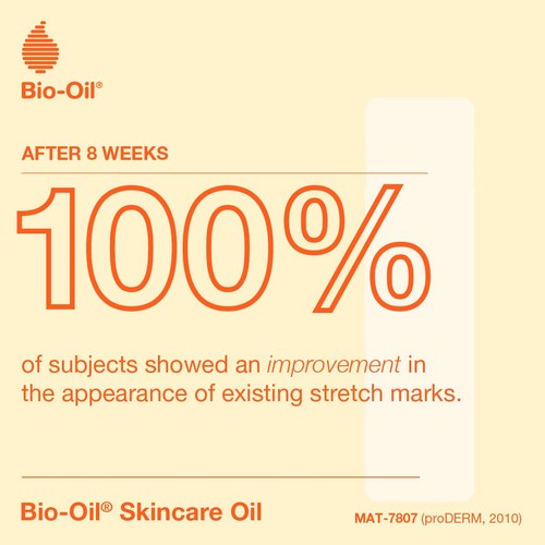 Bio-Oil Skincare Oil  Helps Improve the Appearance of Scars & Stretch Marks