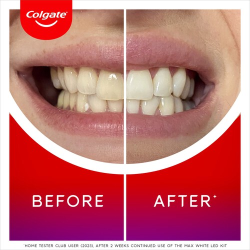 Colgate Max White Ultimate At Home LED Teeth Whitening Kit