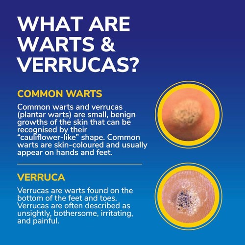 Dr Scholl's Wart & Verruca Freeze Away Max 63g